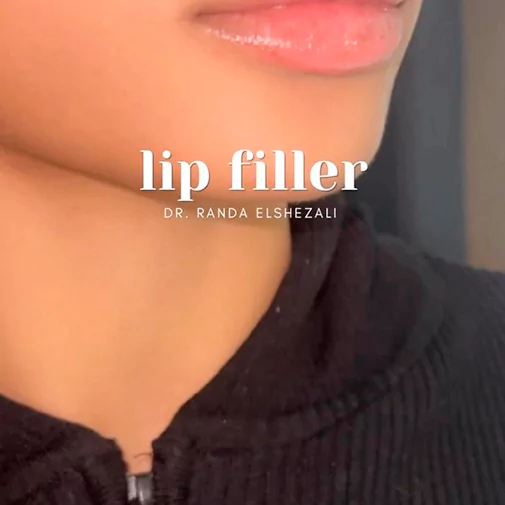 Symphony Clinic Dubai Instagram - beauty results